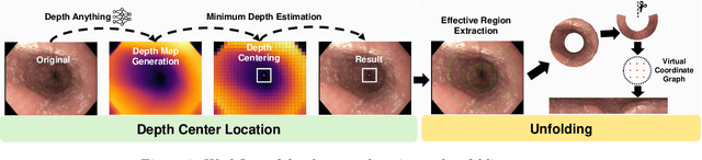 Figure 3 for Automatic Image Unfolding and Stitching Framework for Esophageal Lining Video Based on Density-Weighted Feature Matching