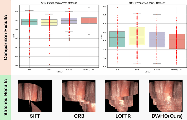 Figure 4 for Automatic Image Unfolding and Stitching Framework for Esophageal Lining Video Based on Density-Weighted Feature Matching