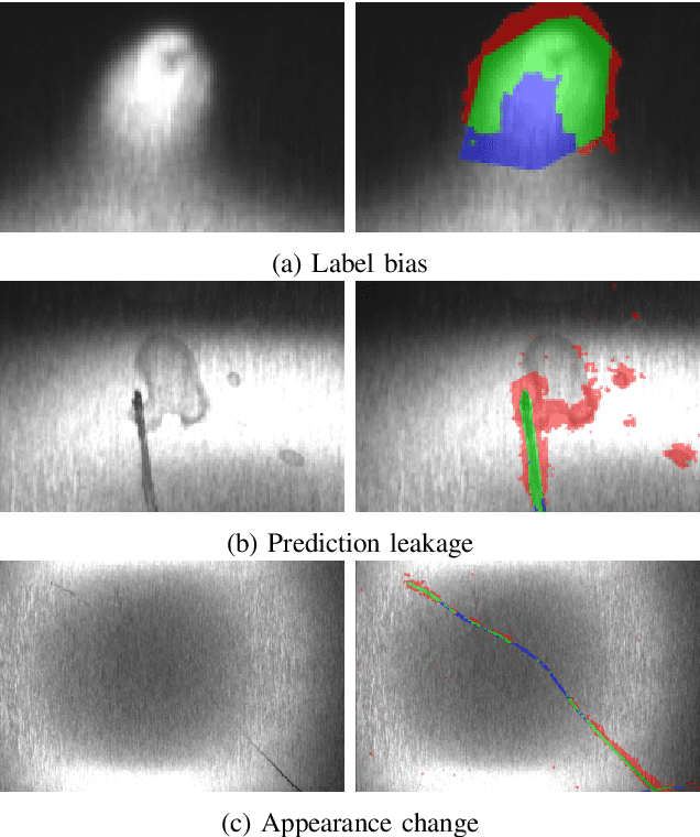 Figure 4 for Sequential PatchCore: Anomaly Detection for Surface Inspection using Synthetic Impurities