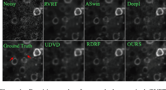 Figure 1 for Unsupervised Microscopy Video Denoising