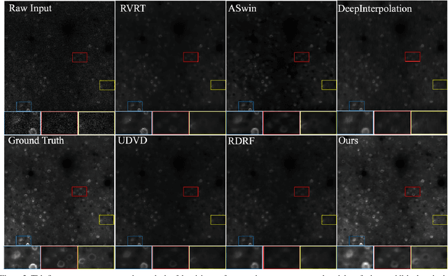 Figure 4 for Unsupervised Microscopy Video Denoising