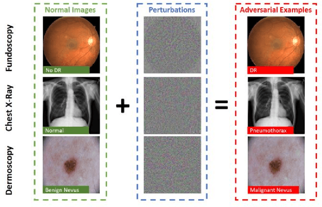 Figure 3 for Securing the Diagnosis of Medical Imaging: An In-depth Analysis of AI-Resistant Attacks