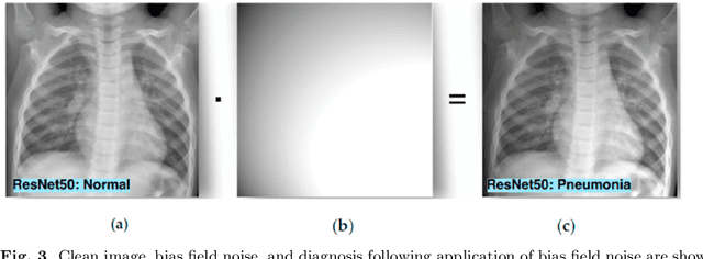 Figure 4 for Securing the Diagnosis of Medical Imaging: An In-depth Analysis of AI-Resistant Attacks