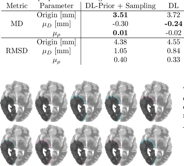 Figure 2 for A Learnable Prior Improves Inverse Tumor Growth Modeling