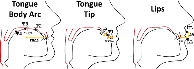 Figure 1 for Perceptual Ratings Predict Speech Inversion Articulatory Kinematics in Childhood Speech Sound Disorders
