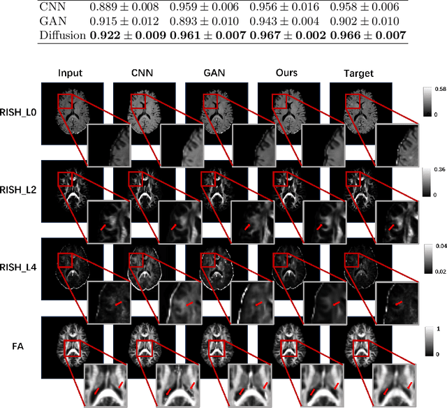 Figure 2 for When Diffusion MRI Meets Diffusion Model: A Novel Deep Generative Model for Diffusion MRI Generation