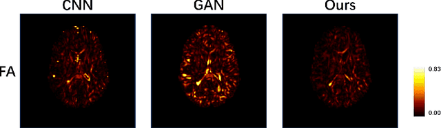 Figure 4 for When Diffusion MRI Meets Diffusion Model: A Novel Deep Generative Model for Diffusion MRI Generation