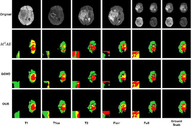 Figure 2 for Robust Brain Tumor Segmentation with Incomplete MRI Modalities Using Hölder Divergence and Mutual Information-Enhanced Knowledge Transfer