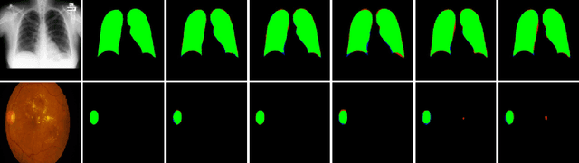 Figure 2 for TBConvL-Net: A Hybrid Deep Learning Architecture for Robust Medical Image Segmentation