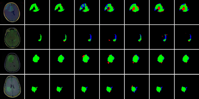 Figure 3 for TBConvL-Net: A Hybrid Deep Learning Architecture for Robust Medical Image Segmentation