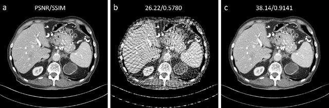 Figure 4 for Patch-Based Denoising Diffusion Probabilistic Model for Sparse-View CT Reconstruction