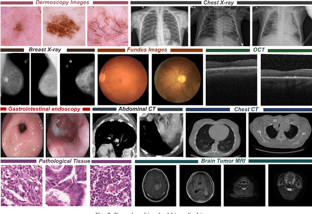 Figure 2 for Out-of-distribution Detection in Medical Image Analysis: A survey