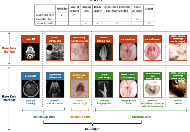 Figure 3 for Out-of-distribution Detection in Medical Image Analysis: A survey