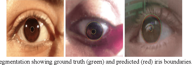 Figure 1 for Robust Iris Centre Localisation for Assistive Eye-Gaze Tracking