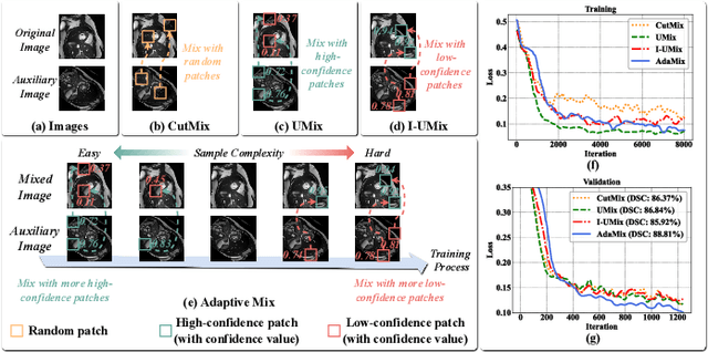 Figure 1 for Adaptive Mix for Semi-Supervised Medical Image Segmentation