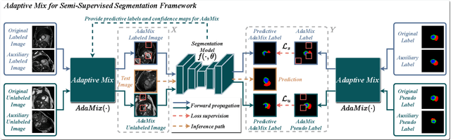 Figure 3 for Adaptive Mix for Semi-Supervised Medical Image Segmentation