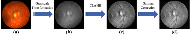 Figure 3 for TransUNext: towards a more advanced U-shaped framework for automatic vessel segmentation in the fundus image