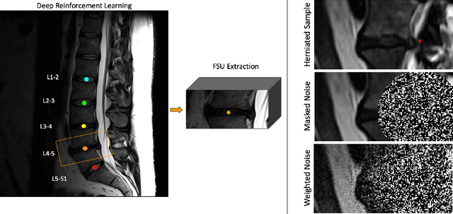 Figure 1 for Inpainting Pathology in Lumbar Spine MRI with Latent Diffusion