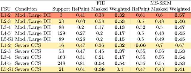 Figure 2 for Inpainting Pathology in Lumbar Spine MRI with Latent Diffusion