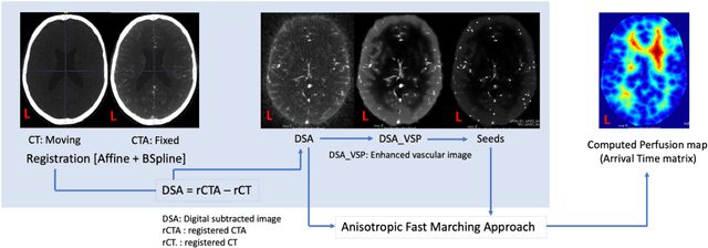 Figure 1 for Deep generative computed perfusion-deficit mapping of ischaemic stroke