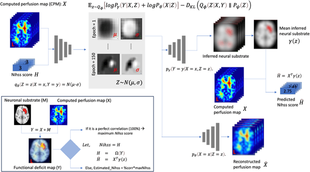 Figure 2 for Deep generative computed perfusion-deficit mapping of ischaemic stroke