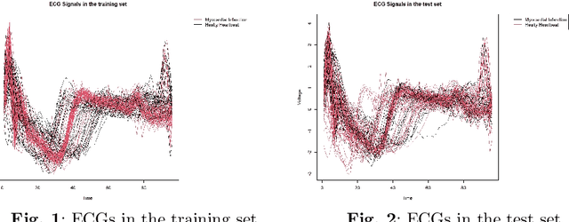 Figure 1 for Augmented Functional Random Forests: Classifier Construction and Unbiased Functional Principal Components Importance through Ad-Hoc Conditional Permutations