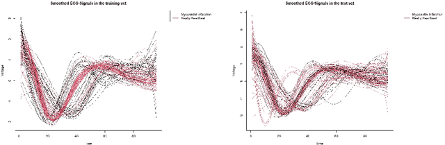 Figure 4 for Augmented Functional Random Forests: Classifier Construction and Unbiased Functional Principal Components Importance through Ad-Hoc Conditional Permutations