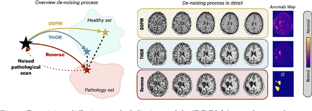 Figure 1 for Diffusion Models with Implicit Guidance for Medical Anomaly Detection