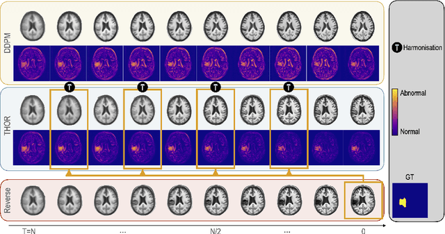 Figure 3 for Diffusion Models with Implicit Guidance for Medical Anomaly Detection