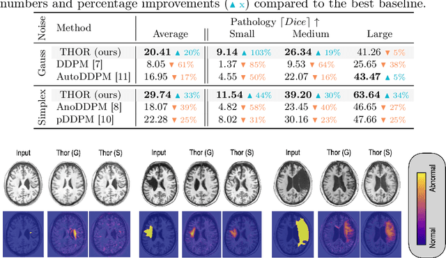 Figure 2 for Diffusion Models with Implicit Guidance for Medical Anomaly Detection