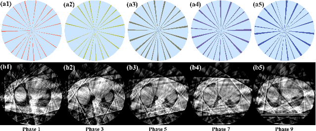 Figure 2 for RSTAR: Rotational Streak Artifact Reduction in 4D CBCT using Separable and Circular Convolutions