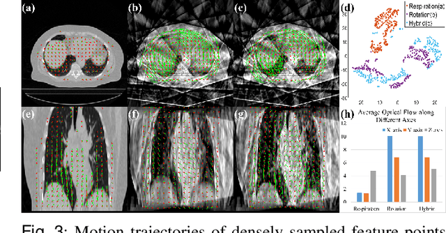 Figure 3 for RSTAR: Rotational Streak Artifact Reduction in 4D CBCT using Separable and Circular Convolutions