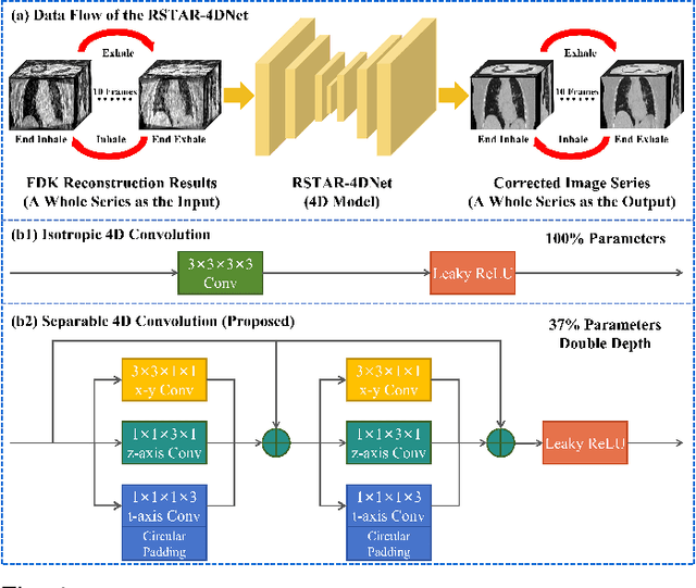 Figure 4 for RSTAR: Rotational Streak Artifact Reduction in 4D CBCT using Separable and Circular Convolutions