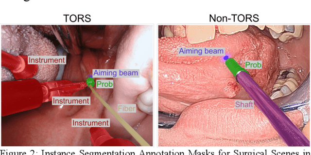 Figure 4 for Data-Centric Learning Framework for Real-Time Detection of Aiming Beam in Fluorescence Lifetime Imaging Guided Surgery