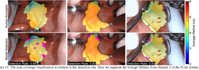 Figure 2 for Data-Centric Learning Framework for Real-Time Detection of Aiming Beam in Fluorescence Lifetime Imaging Guided Surgery