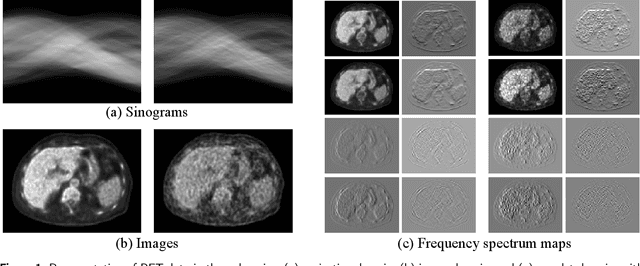 Figure 1 for End-to-end Triple-domain PET Enhancement: A Hybrid Denoising-and-reconstruction Framework for Reconstructing Standard-dose PET Images from Low-dose PET Sinograms