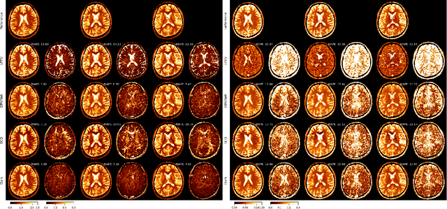 Figure 2 for Improved Patch Denoising Diffusion Probabilistic Models for Magnetic Resonance Fingerprinting