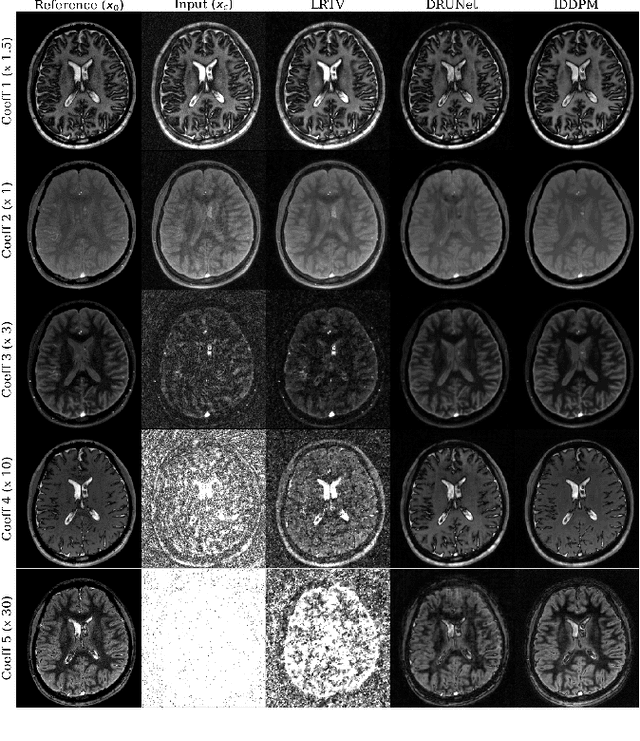 Figure 4 for Improved Patch Denoising Diffusion Probabilistic Models for Magnetic Resonance Fingerprinting