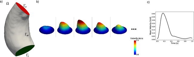 Figure 1 for Implicit neural representations for unsupervised super-resolution and denoising of 4D flow MRI