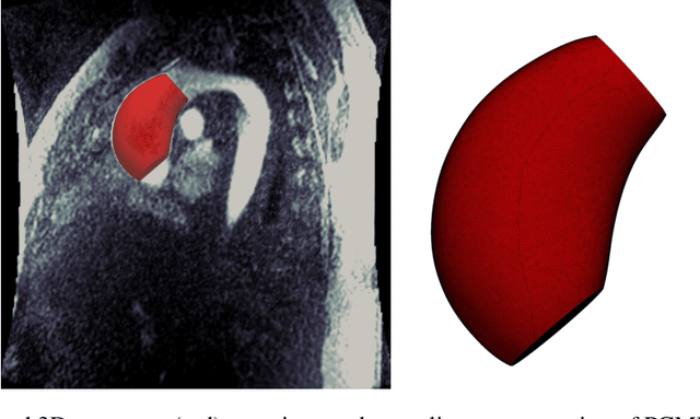 Figure 4 for Implicit neural representations for unsupervised super-resolution and denoising of 4D flow MRI