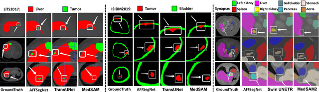 Figure 4 for ASSNet: Adaptive Semantic Segmentation Network for Microtumors and Multi-Organ Segmentation