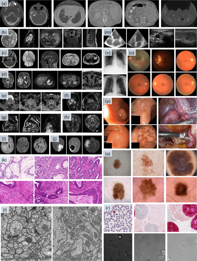 Figure 1 for Segment Anything Model for Medical Images?