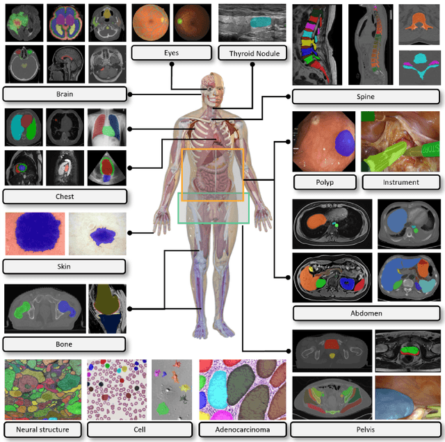 Figure 3 for Segment Anything Model for Medical Images?