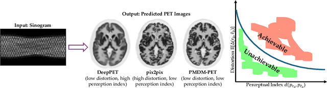 Figure 1 for Posterior-Mean Denoising Diffusion Model for Realistic PET Image Reconstruction