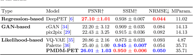Figure 2 for Posterior-Mean Denoising Diffusion Model for Realistic PET Image Reconstruction