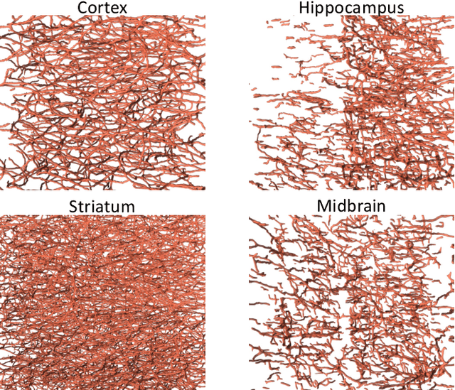 Figure 1 for Topological Analysis of Mouse Brain Vasculature via 3D Light-sheet Microscopy Images