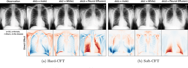 Figure 2 for Mitigating attribute amplification in counterfactual image generation