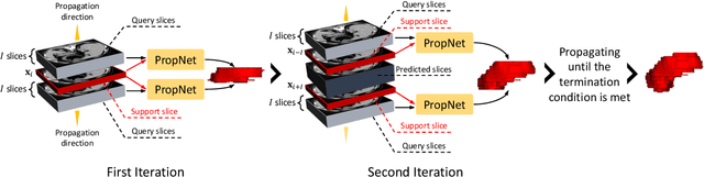 Figure 3 for propnet: Propagating 2D Annotation to 3D Segmentation for Gastric Tumors on CT Scans