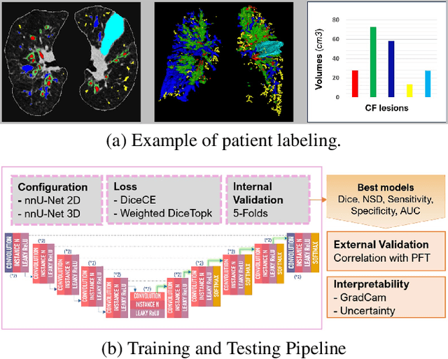 Figure 1 for CT evaluation of 2D and 3D holistic deep learning methods for the volumetric segmentation of airway lesions