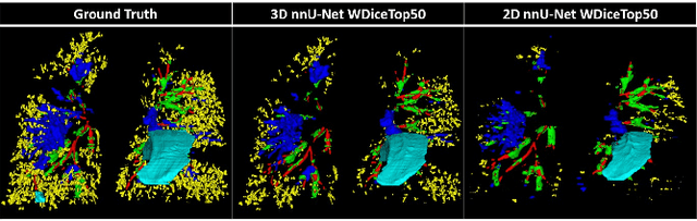 Figure 3 for CT evaluation of 2D and 3D holistic deep learning methods for the volumetric segmentation of airway lesions